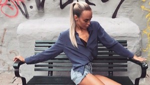 Za INÉ nohy sa jej v detstve posmievali: Dnes je vďaka nim úspešnou modelkou