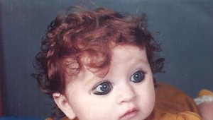 Keď sa narodila, zľakli sa, že je chorá: Pozrite sa na jej rodičov a pochopíte dôvod