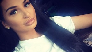 Zuza otvorene o plastikách. Odkaz pre všetky ženy, ktorý vás ŠOKUJE!