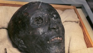 Tutanchamóna skolila zlomená noha a malária