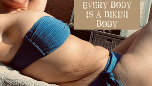 Poznáte kráľovnú jojo efektu? Kráske sa podarilo zhodiť cez 50 kíl, ale jej telo to nezvládlo