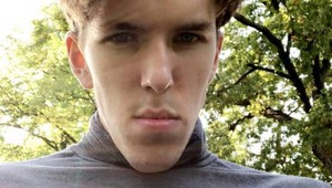 Kvôli svojej tvári zažíval hotové muky, operácia mu zmenila život: Je TO vôbec možné?