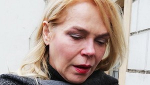 Dagmar Havlová: Vážny úraz na ulici