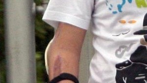 9 vecí, ktoré môžete urobiť pre svoje kĺby počas života: S liekmi však opatrne!