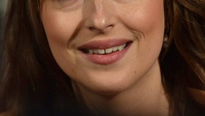 Známa herečka prekvapila estetickým zákrokom: Fanúšikom sa takto nepáči!