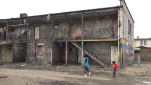 V jednej z východoslovenských osád sa šíri tuberkulóza, dvojročné dieťa je vo vážnom stave