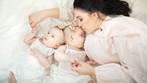 Dvojčatá zrastené hlavami oddeľovali 24 hodín: Výsledok unikátneho zákroku dojíma ľudí