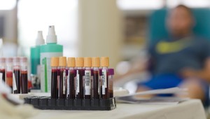 Rozmýšľate nad darovaním krvi? Jedna skupina má hraničné zásoby