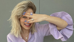 Takto ste Ivanu Gáboríkovú ešte nevideli: Odhalila tvár posiatu pigmentovými fľakmi