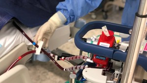 V banskobystrickej nemocnici dávajú novú nádej na záchranu pacientom s ťažkým podchladením