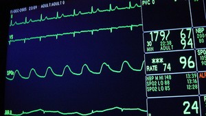 Nepodceňujte príznaky srdcového ochorenia. Leto je pre srdce náročným obdobím