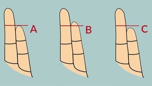 Dobre si všimnite, ako vyzerá váš malíček: Jeho dĺžka o vás prezradí zaujímavé veci