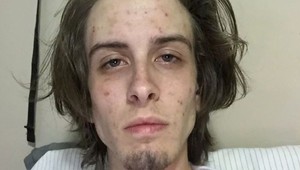 Mladík závislý na ťažkých drogách TO dokázal: Pozrite sa, ako vyzerá po dvoch rokoch