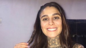 Z hendikepu urobila svoju prednosť: Takto dnes vyzerá jej zjazvené telo po požiari