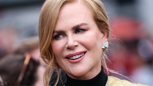 Aké skrášľujúce zákroky podstúpila Nicole Kidman? Ako tínedžerka vyzerala úplne inak!