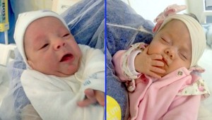 Zázrak medicíny: Štyri mesiace mŕtva žena priviedla na svet dvojičky