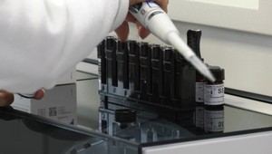 Slovensko odmietlo novelu WHO: Čo sa skrýva za týmto krokom?