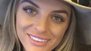 Na večierku si nechala zväčšiť pery: Keď vytriezvela, čakal ju ŠOK!