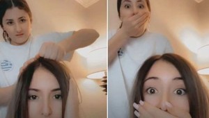 Sociálne siete ovládla nová vlasová výzva: Pozor! Scalp Popping je podľa odborníkov nebezpečný