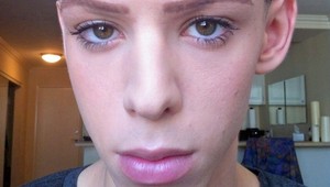 Už ako tínedžer bol iný: Chalan podstúpil viac ako 100 zákrokov, strasie vás, ako vyzerá