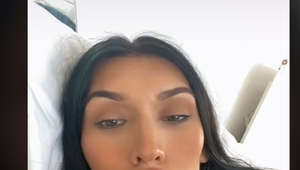 Vždy, keď ju frajer opustí, nechá si zväčšiť pery: Videli ste už takéto ústa?