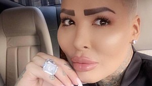 Chlapík posadnutý Kardashiankou šokuje: Ukázal ZADOK po nevydarenej plastike