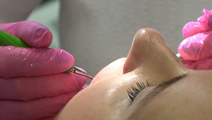 Bolí to menej v peňaženke: Slováci si radšej dajú zuby vytrhnúť než liečiť