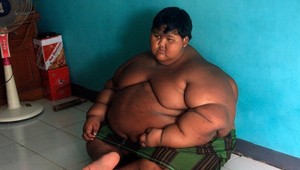 Ako 10-ročný sa stal najtučnejším dieťaťom sveta a vážil 192 kíl: Čo je s ním dnes?