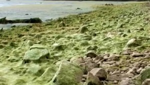 Vyrážka plavcov: Poznáte alergiu z vody?