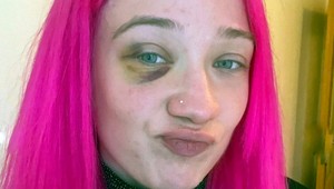 Monokel a strhaná tvár! Ružovovlasá Tereza priznala trpkú skutočnosť, trápenie je späť!