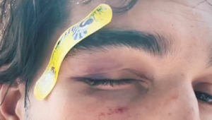 Ochrankárovi preplo?! Na koncerte bezdôvodne dobil hudobníka, partnera známej speváčky!