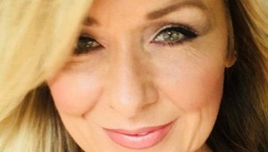 Dlhých 25 rokov si neodlíčila riasenku: Keď lekár uvidel jej oči, zostal v šoku!