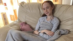 Telo skrývala pod vrstvami oblečenia, potom prišiel ŠOK: Anorektička vážila iba 25 kíl!