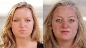 Málo spánku škodí kráse: Takto budete vyzerať, ak spávate menej ako 6 hodín!