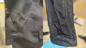 Kaliňák ukázal zábery Ficovho oblečenia po atentáte. Prestrelili mu sako, košeľa bola nasiaknutá krvou