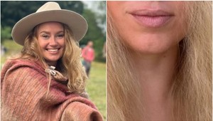 UHORKOVÝ trik na vlasy? Natália Puklušová to skúsila a môže ľutovať ... To je VÝBUCH!