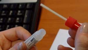 Pozvánky na preventívne vyšetrenia rakoviny nie sú novinkou, tvrdí odborník. Pacienti ich nevyužívajú