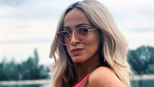 Mirgová to konečne priznala! Má za sebou TÚTO plastickú operáciu!