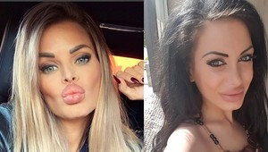 TOTO sú najväčšie pery Slovenska: Kucherenko aj Simonka môžu len ticho závidieť