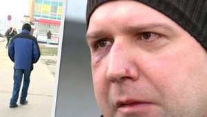 Hyenizmus v Leviciach. Olúpili hendikepovaného muža (36)