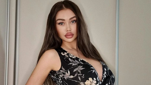 Slovenka s najväčšími prsiami a zadkom ukázala, ako vyzerala pred zákrokmi: Wau, je TOTO vôbec možné?