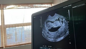 Najskôr priznala psychické problémy, teraz TEHOTENSTVO. Svetová hviezda je konečne šťastná