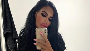 Chcela mať krásny dekolt, ten sa však nevydaril: Jej prsia by nechcela mať žiadna žena!