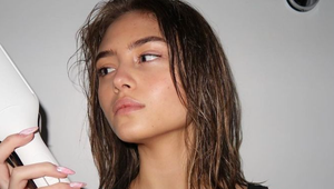 Pred objektívmi dokonalá, skutočnosť je iná! Mladučká kráska otvorene UKÁZALA problém!