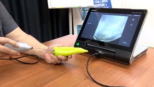 Nová liečebná metóda umožňuje operácie bez narkózy