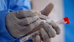 Traja ľudia, ktorí pricestovali zo zahraničia ako negatívni, boli doma po pár dňoch pozitívni