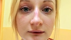 Status zúfalej českej doktorky: Ľudia, nebláznite, TAKTO sa nakazíte najrýchlejšie!