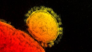 Pandémia za dverami? Smrteľný vírus sa šíri