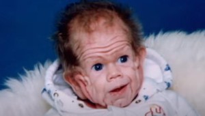 Je JEDINÝ na svete, ktorý sa narodil s takouto kožou: Dnes má 27 rokov a nespoznali by ste ho!