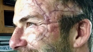 David Beckham ŠOKUJE jazvami na tvári!